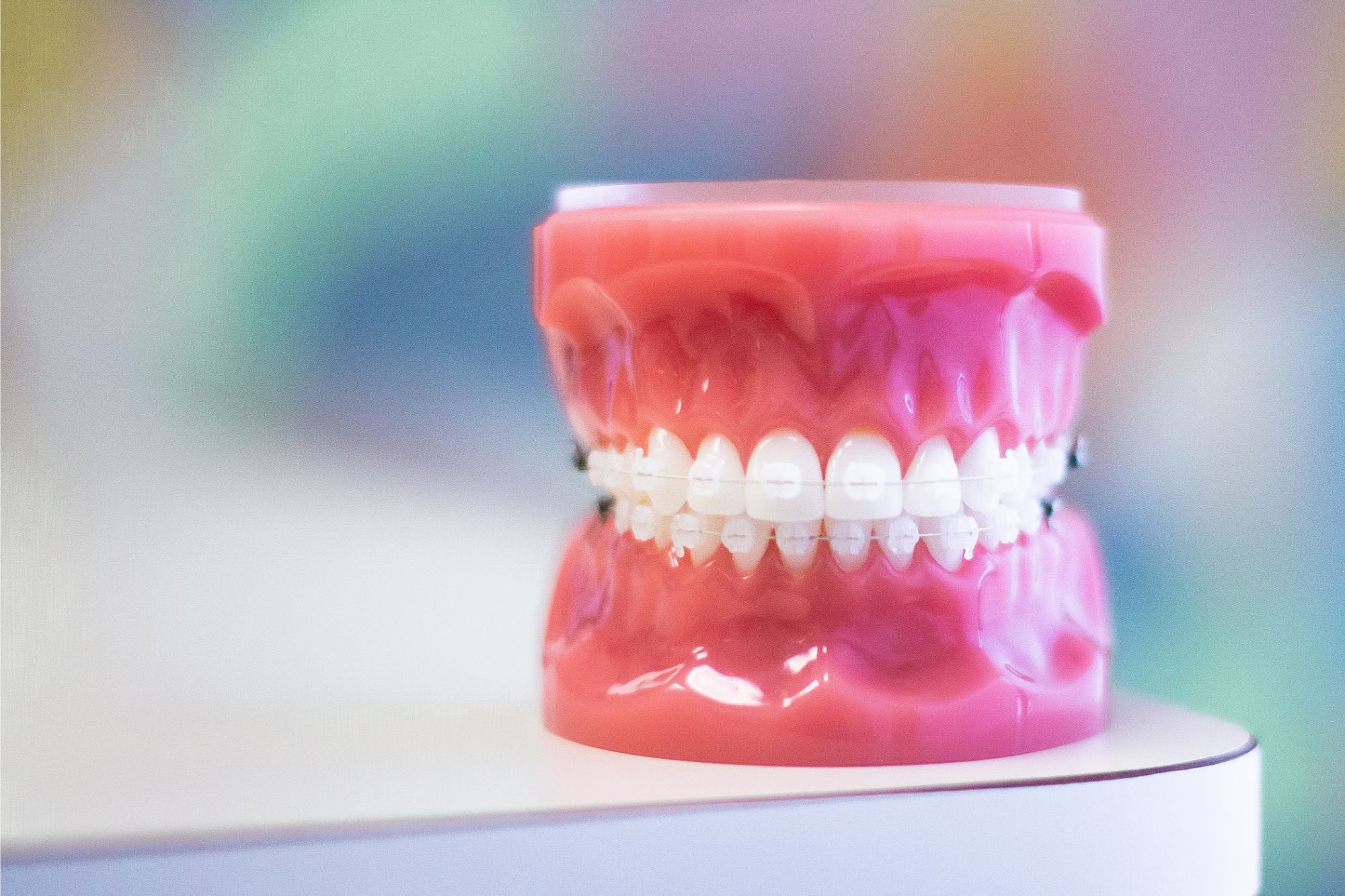 Clear braces surrey bc
