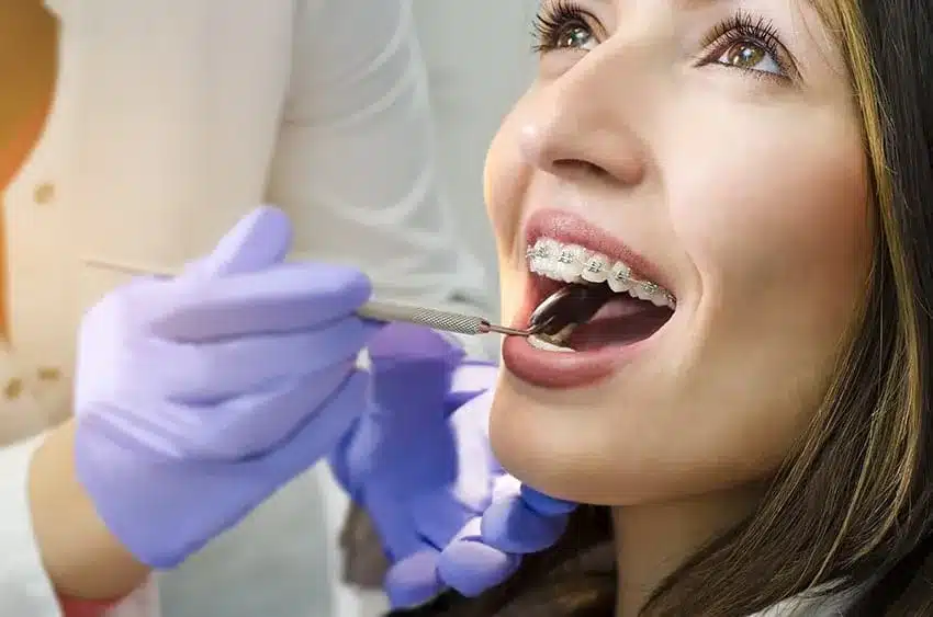 Orthodontic checkup of a woman with metal braces during dental appointment