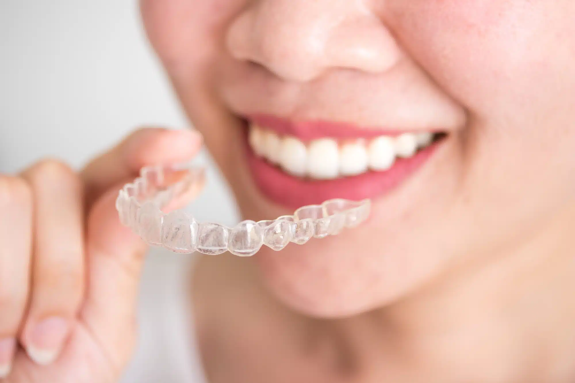 Close-up of a smiling person holding a clear Invisalign aligner near their teeth